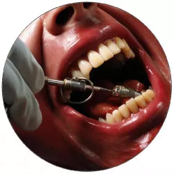 Élelmezési papír beteg a fogorvosnál 19,5 cm